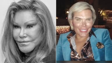 15 People Who Did Doll Surgery on Their Face and Body