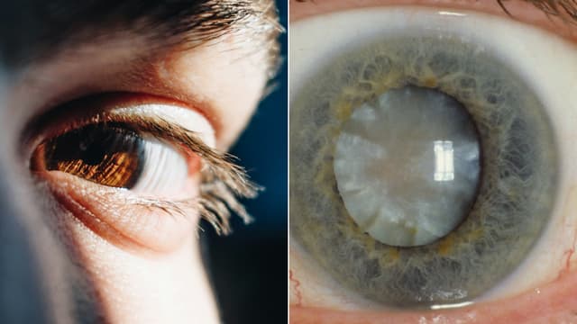 Do you also feel you are loosing your vision at early age?